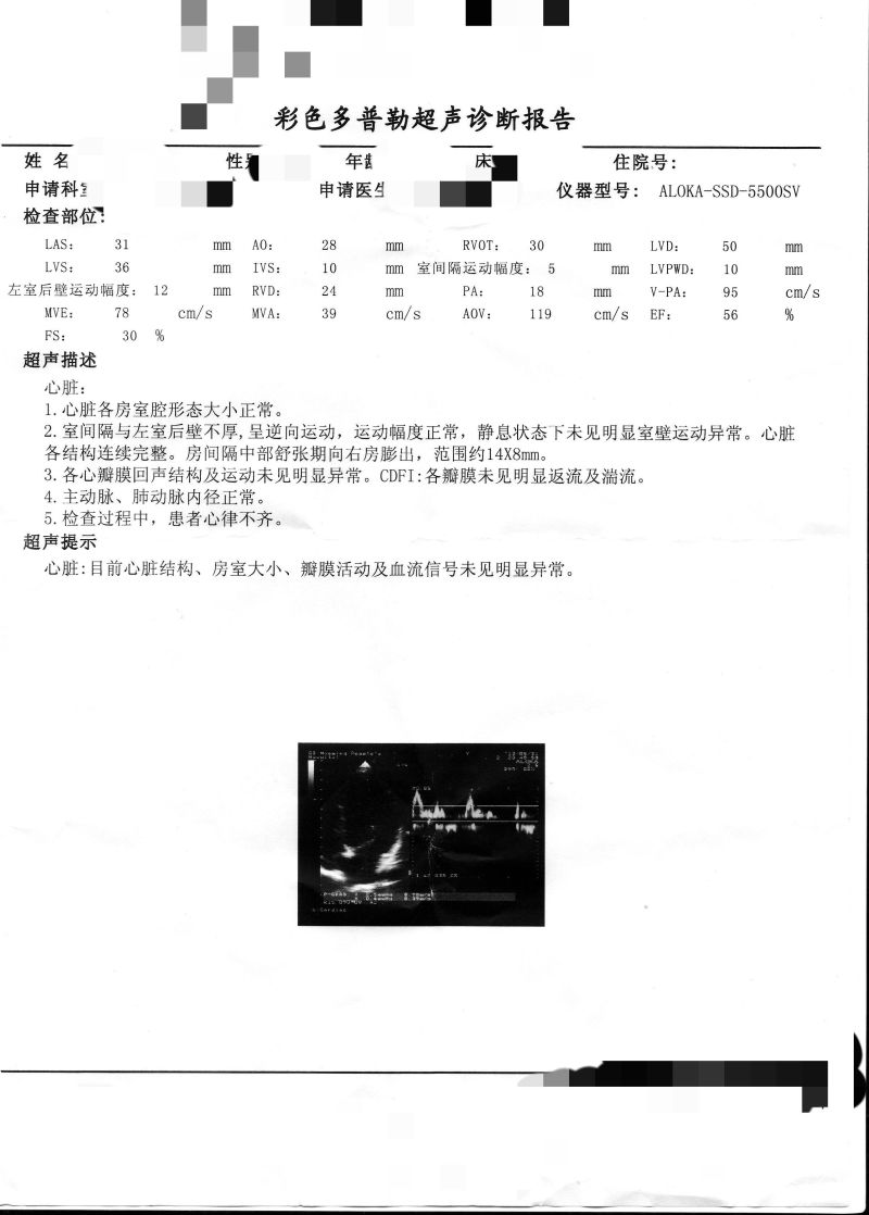 公务员体检结论怎么下（公务员体检结果怎么写）